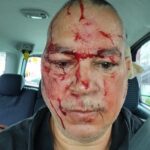 WIN Candidate assaulted by Guyanese Critic