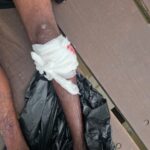 Man Arrested After Alleged Stabbing of Teen Mother in Berbice River